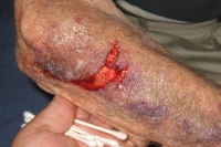 skin tears immagine skin tears