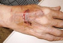 skin tears immagine skin tears